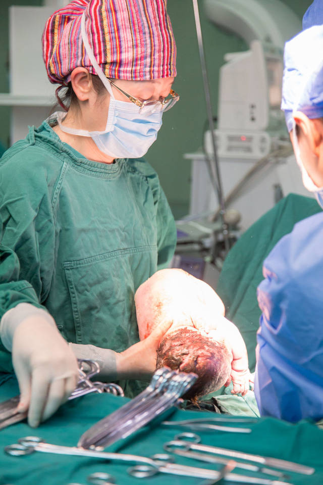 图中的医生正在为一名抢救手术后的妊娠合并子宫瘢痕的孕妇,进行最后