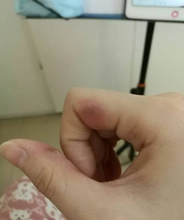 光鲜亮丽 伤痕累累tat 小提琴,中提琴到大提琴 琴弦越来越粗 磨出茧子