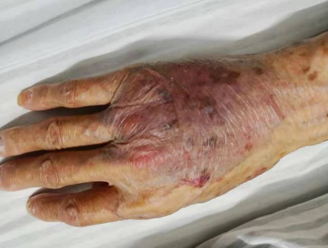 如何正确处理?_手机搜狐网