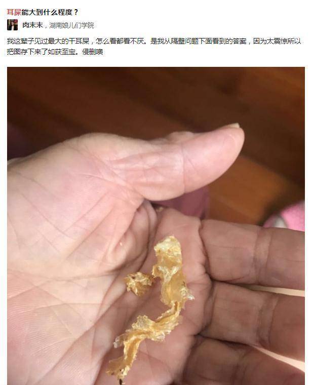 掏耳勺能碰到耳膜吗图片