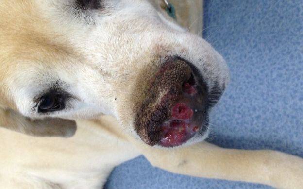 ②皮肤鳞状上皮细胞瘤