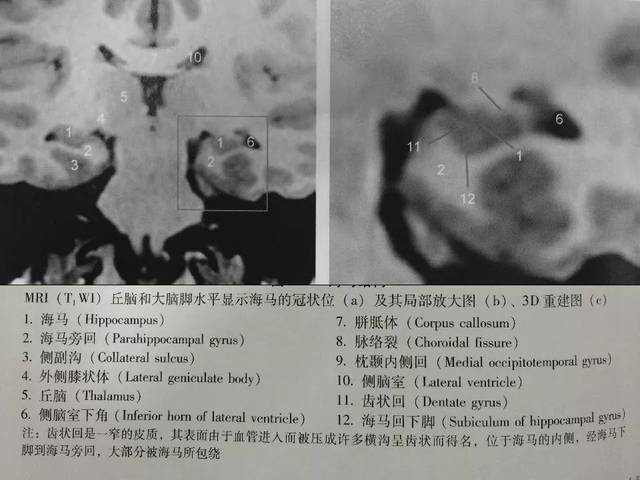 海马区断层解剖图片