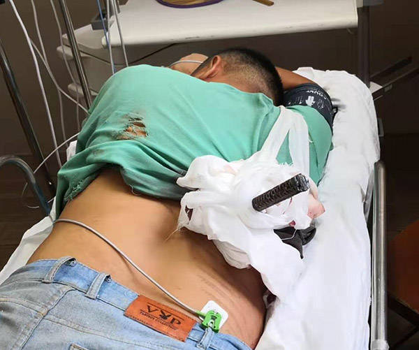 男子高空坠落被60厘米长钢筋贯穿胸腹医生消防员合力抢救