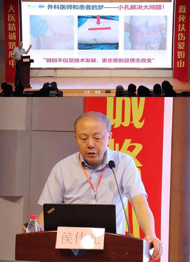 成都首届脊柱外科研讨会顺利召开