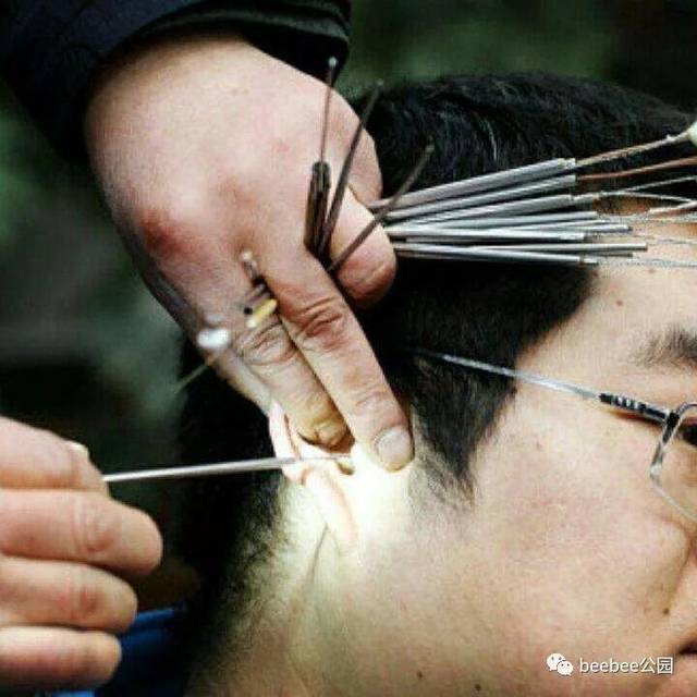 掏耳朵这事儿不能这么简单理解.