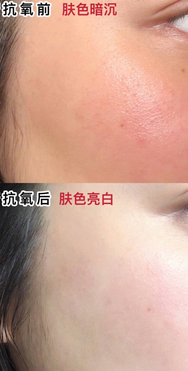 什么是抗氧化你真的了解吗皮肤抗氧化从哪些方面着手