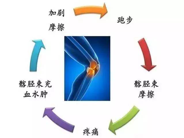 相关学者还提出,膝关节在屈曲30°的时候有一个影响区(impingement