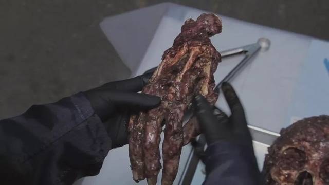 10部重口法医剧,留着吃饭刷!