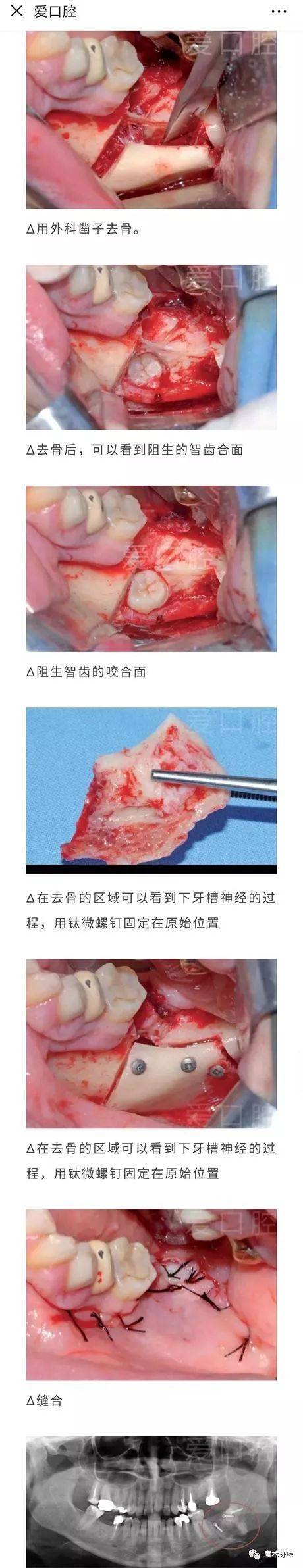 备孕期,哺乳期的妈妈应该注意什么?