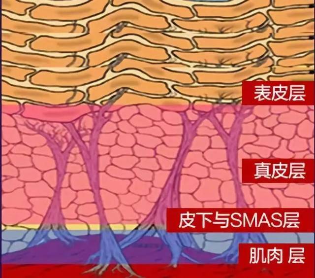 皮肤内弹性纤维断裂图图片