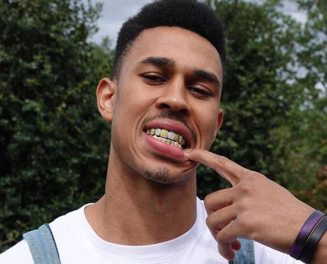 暴发户不怕疼!拿到千万合同 潜力新秀原装大白牙 换成镶钻大金牙