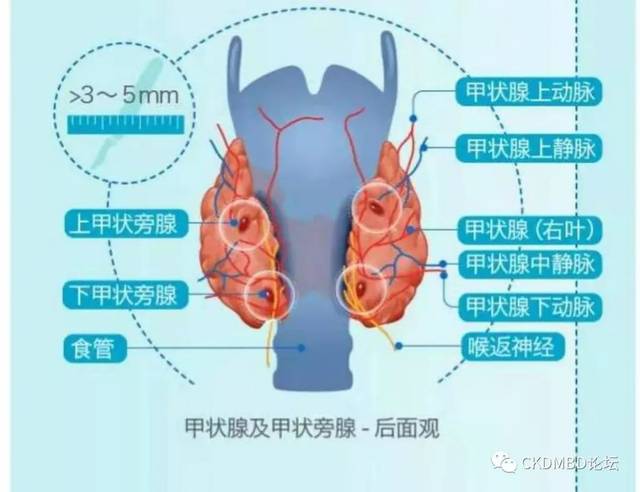 甲状旁腺模式图图片