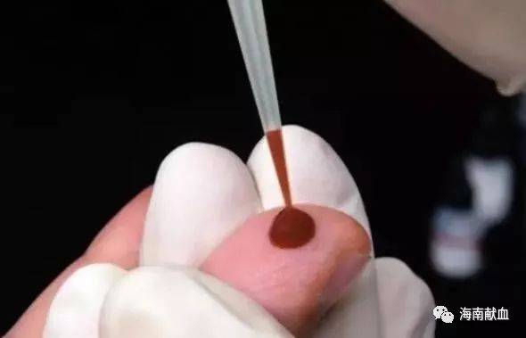 扎手指,抽手臂,原来采血也有大学问!