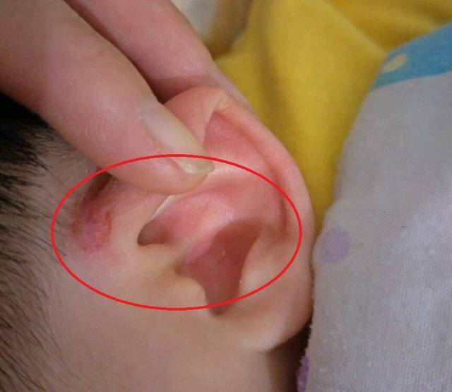 孩子睡觉起鸡皮疙瘩咋回事(宝宝发烧睡觉身上起鸡皮疙瘩)