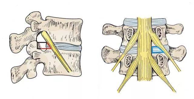 麻醉科医师900问 椎间孔与脊神经干阻滞有何关系?