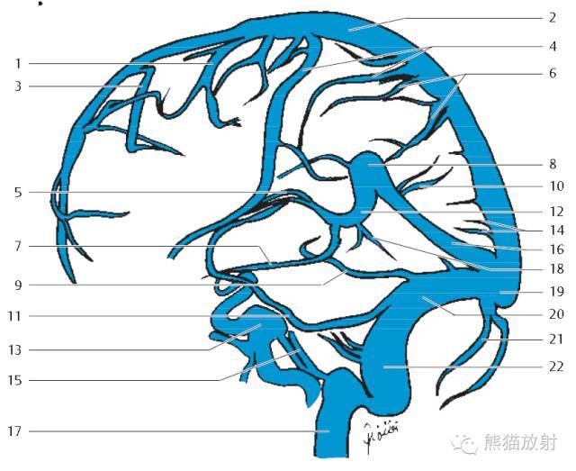 解剖丨脑膜及其血供、硬脑膜静脉窦、MRV(双语)_手机搜狐网
