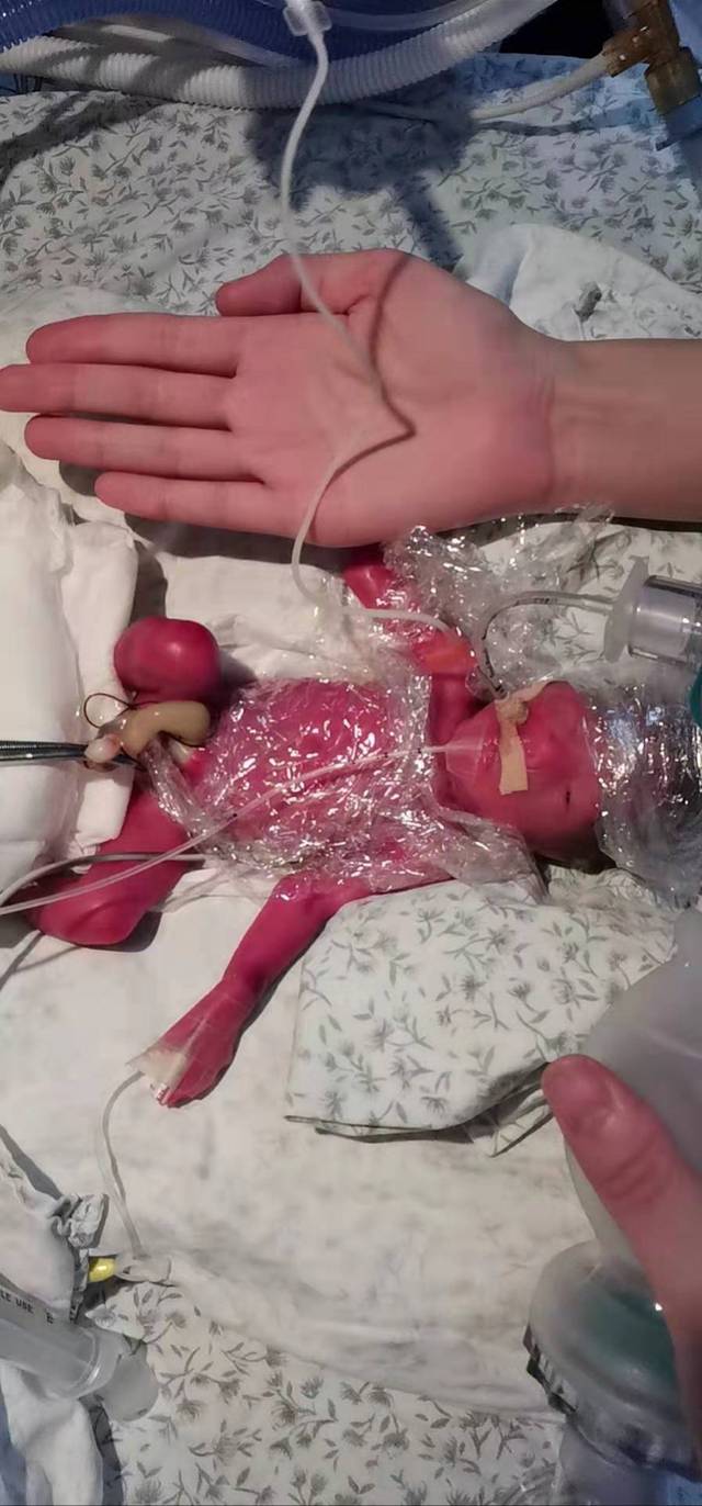 做试管婴儿并不是依照移植胚胎的个数来收费的,而是做试管婴儿的整个