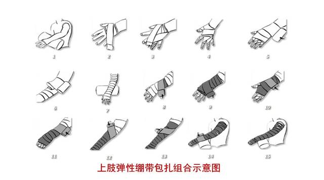 淋巴水肿问题日益受到关注,治疗方案不断革新