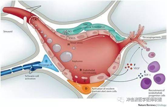 体外冲击波"打松"创伤后产生的黏连,结痂软组织疼痛