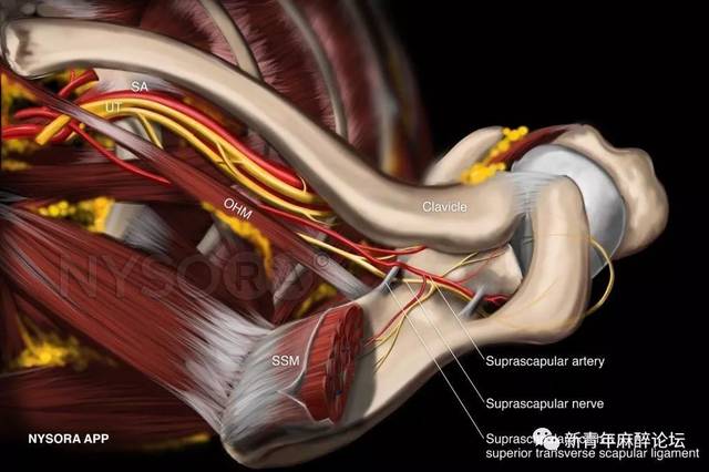 超聲引導肩胛上神經和腋神經阻滯(科普)