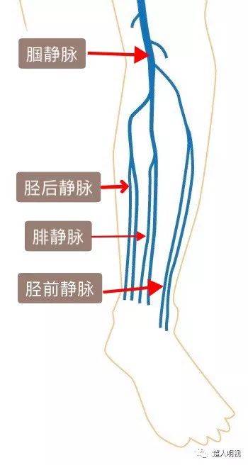下肢肌间静脉图片