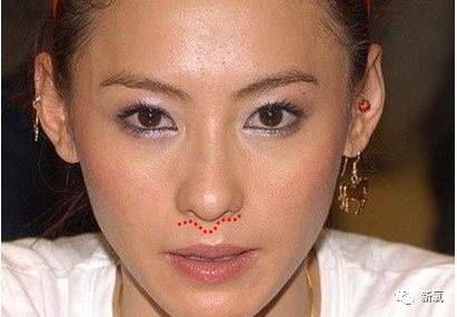 杨紫脸又变了?鼻基底假体厚到合不上嘴!变猴型