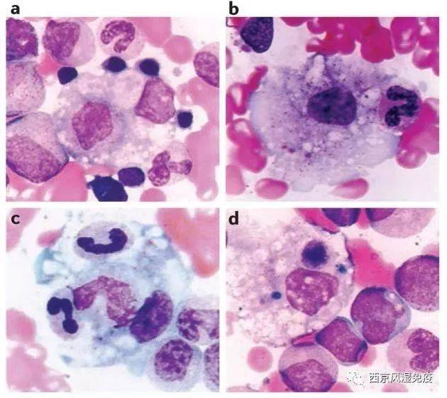 巨噬细胞瑞氏染色图片