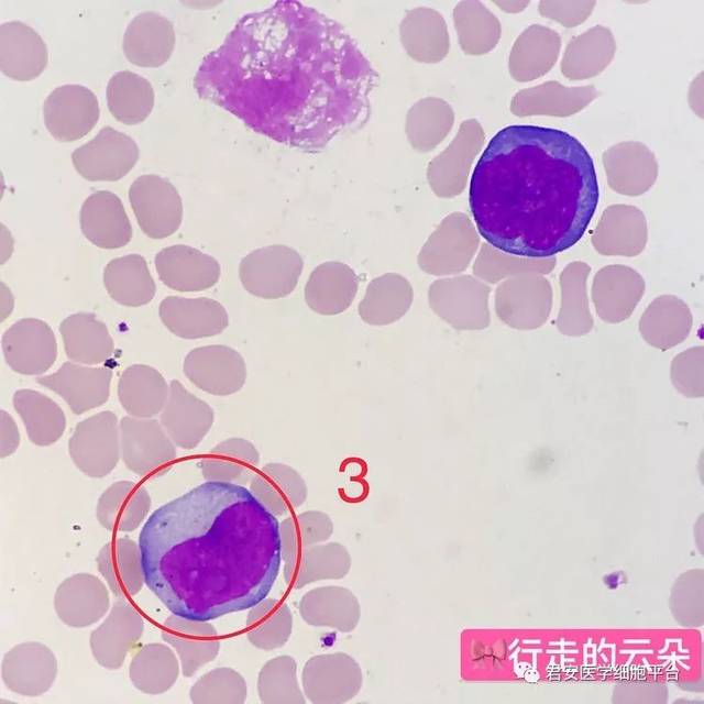 看图识细胞第56期