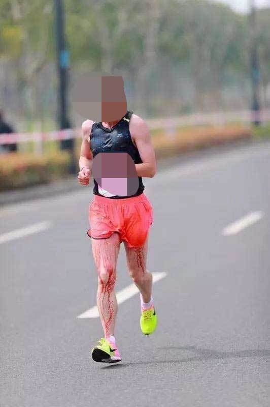跑者跑马拉松裆部被磨破 这些部位要提前做防护