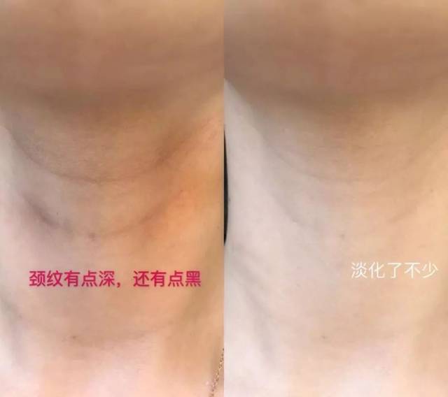 天鹅颈怎么练图解,天鹅颈怎么练,天鹅颈图片(第15页)_大山谷图库