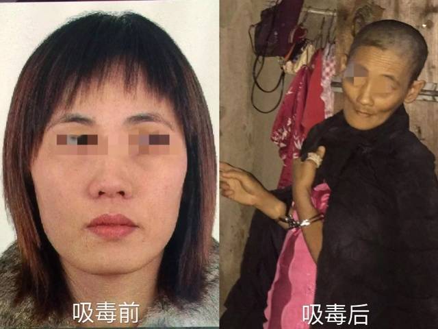 吸毒后血腥图片图片