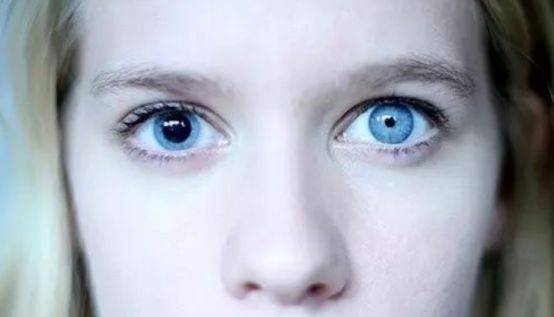 拥有"双瞳孔"的人,他们看到的世界和正常人有什么不一样?_手机搜狐网