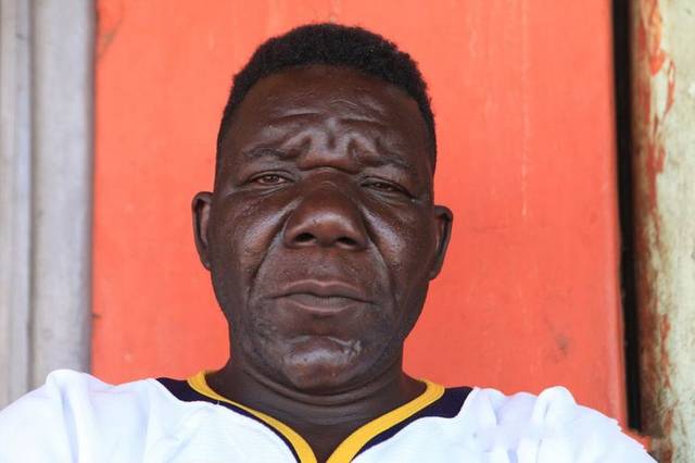 世界上最丑的人,5次选丑大赛4次都是冠军,看完根本吃不下饭!