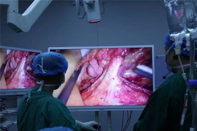 (左右滑动进行翻看) 直肠癌手术直播