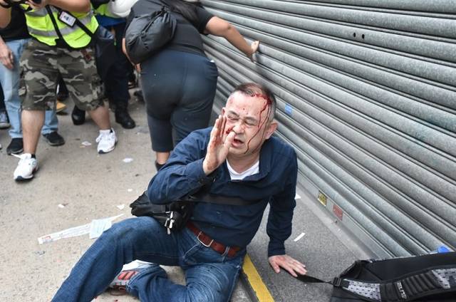 女子香港街头遭暴徒围殴"私了"_手机搜狐网