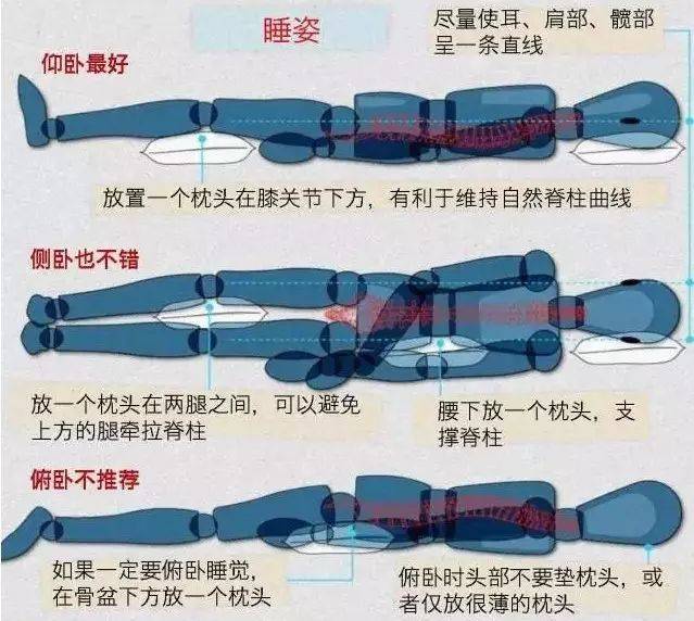 腰间盘突出卧床姿势图片