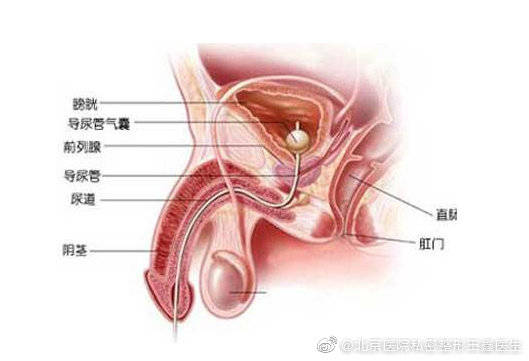 阴茎延长术能延长勃起后长度吗?