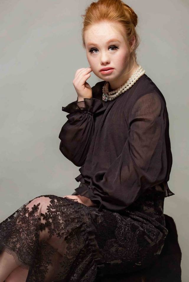 这个22岁的澳洲姑娘,带着改变世界的决心,用笑容和自信震撼整个时尚圈