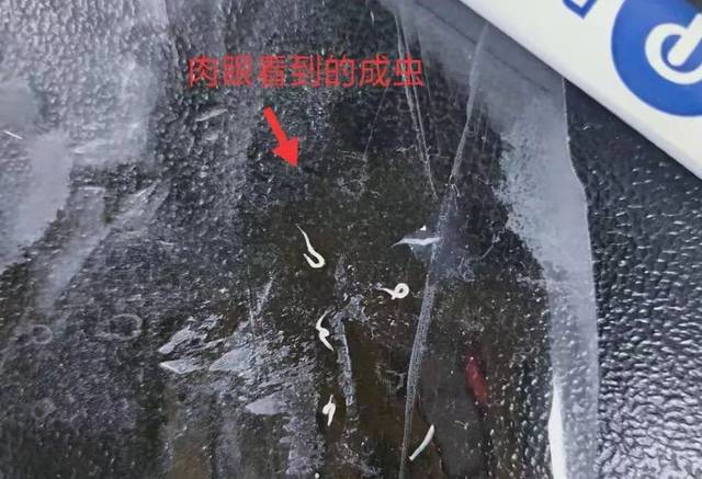 医生在她身上捉出好多白虫子_手机搜狐网