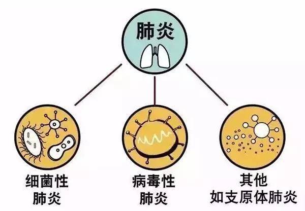 肺炎會感染嗎?常見的致病因素有哪些?