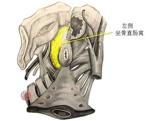 医学笔记|从腹腔侧观察坐骨直肠窝的局部解剖_手机搜狐网