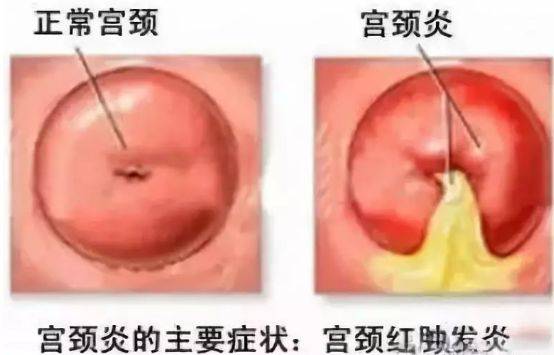 带你全面认识女性的生殖系统《如何保持女性生殖健康》