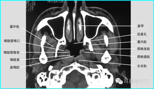 颌下腺ct解剖图图片