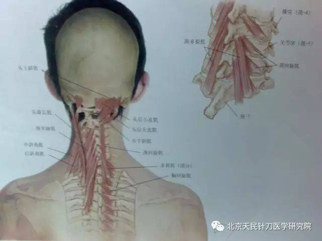 颈椎横突的定位图图片