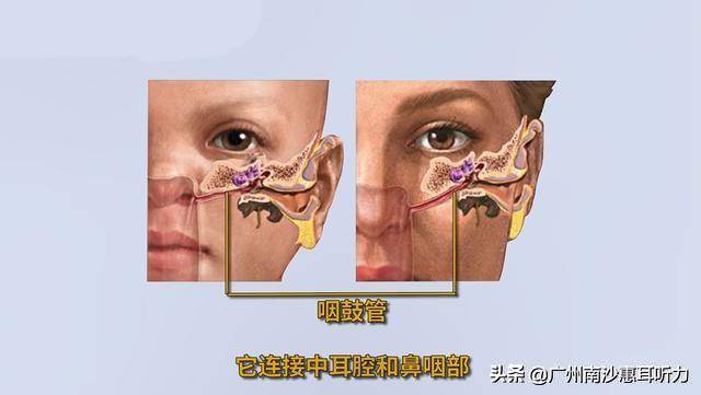 廣州南沙惠耳聽力告訴您一一我的耳朵怎麼會感到悶悶的