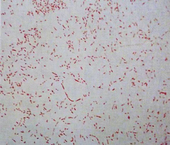 浅谈副猪嗜血杆菌病及其防控措施_手机搜狐网