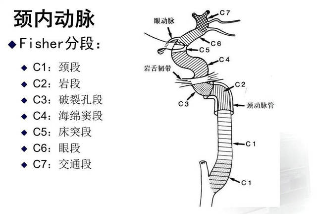 大脑动脉环血管图图片