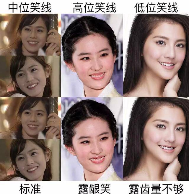 正畸，一图解释“笑得好看”_搜狐网