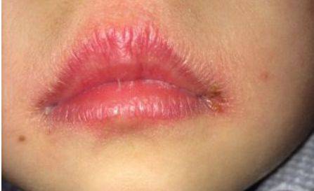 不单是因为缺水,病根在这_手机搜狐网