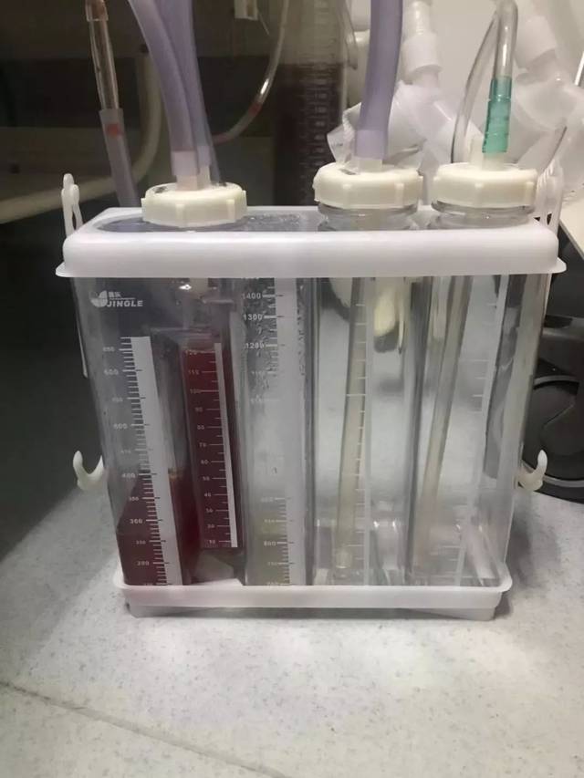 你真的懂胸腔闭式引流瓶吗?